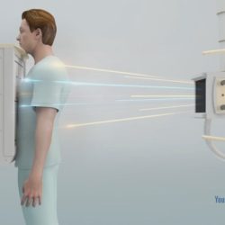 Procedure using xray crossword clue