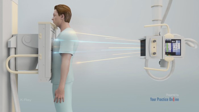 Procedure using xray crossword clue